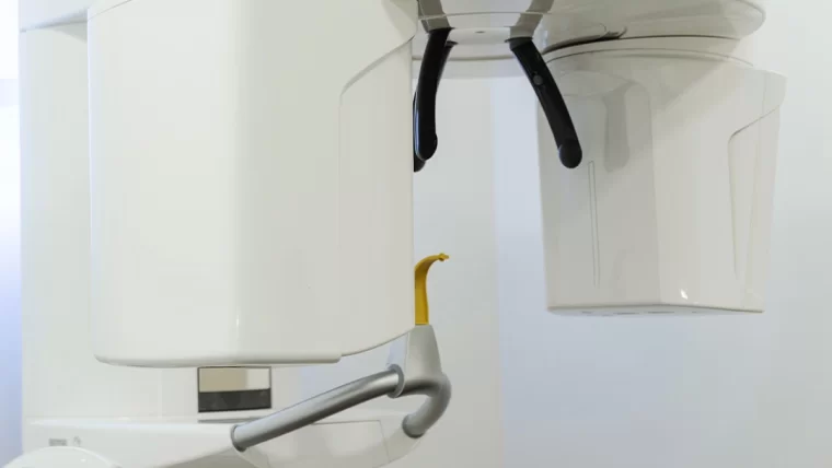 Odontologijos klinika „Meliva“ atsinaujino: pristatome modernų 3D kompiuterinį tomografą