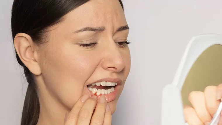 Periodontitas – kaip jį atpažinti ankstyvosiose stadijose?