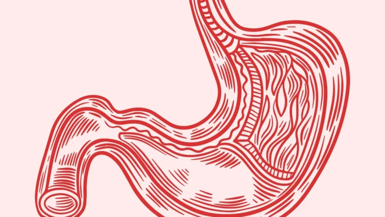Refliuksas: kaip atpažinti požymius ir efektyviai gydyti?