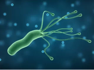 Apie 40–50 proc. pasaulio gyventojų yra užsikrėtę Helicobacter pylori bakterija