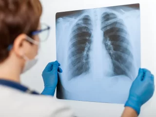 „Kardiolitos klinikose“ atliekami rentgeno tyrimai