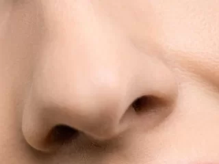 Nosies operacijos gali prireikti ir dėl nosies gleivinę sutraukiančių vaistų vartojimo