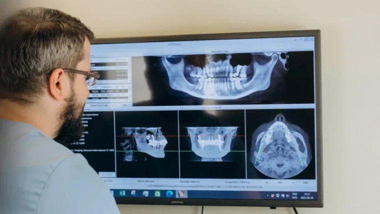 Žandikaulio sąnario skausmo gydymas premium odontologijos klinikoje Kaune