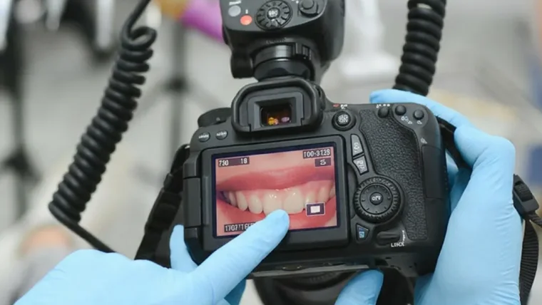 Kodėl odontologijoje svarbus gydymo atvejų fotografavimas?