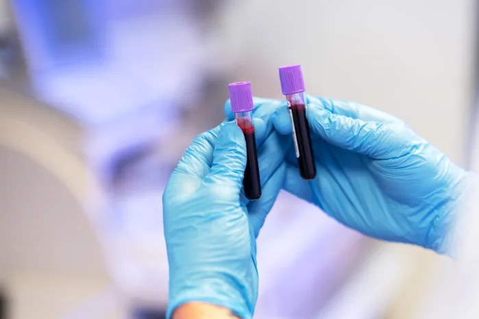 Du mėgintuvėliai su kraujo mėginiais, paruošti laboratoriniam tyrimui