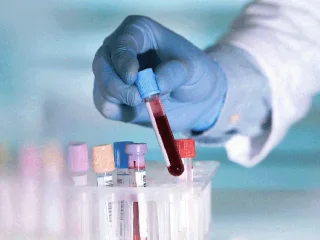 Silpnumas, nuovargis, galvos skausmas gali būti anemijos požymiai